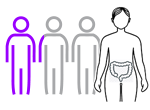 Chances and Symptoms of bowel Cancer