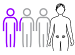 Chances and Symptoms of Ovarian Cancer