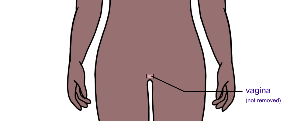 If the ovaries and fallopian tubes are removed